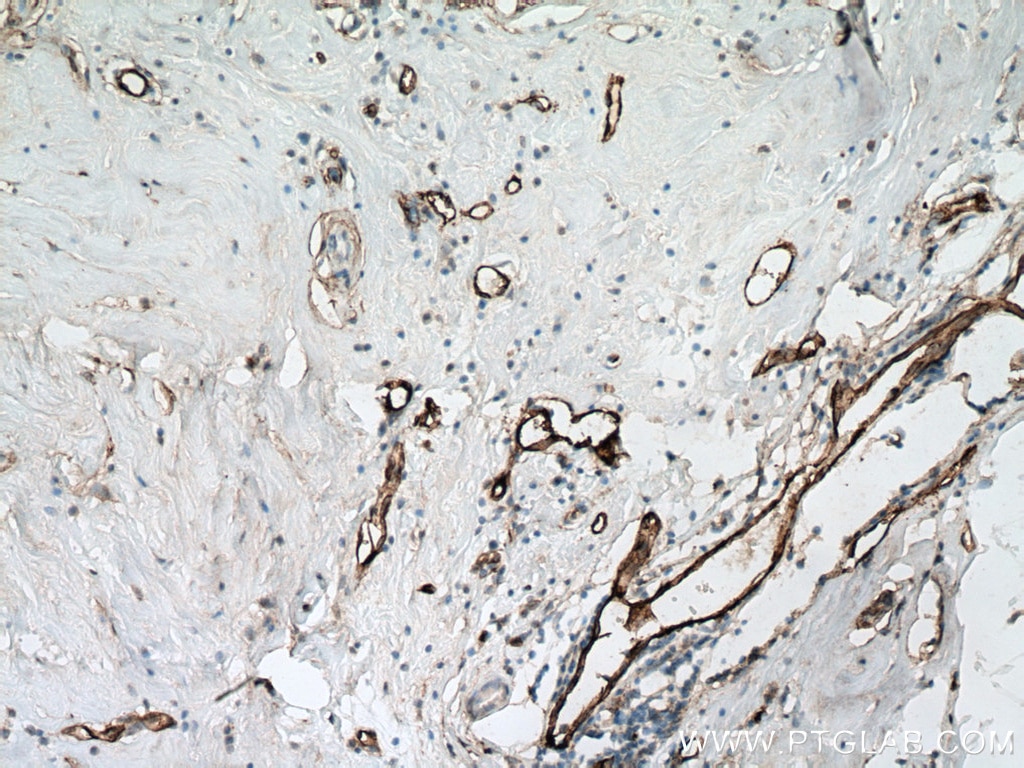 Endoglin/CD105