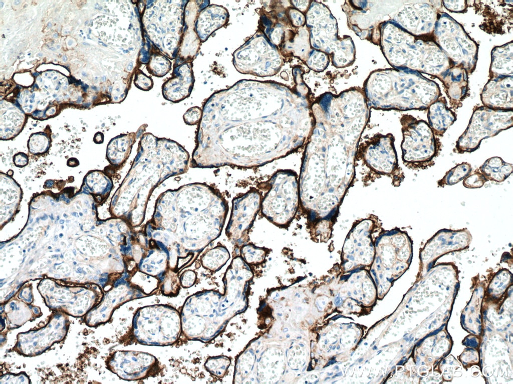 Immunohistochemistry (IHC) staining of human placenta tissue using Endoglin/CD105 Monoclonal antibody (67075-1-Ig)