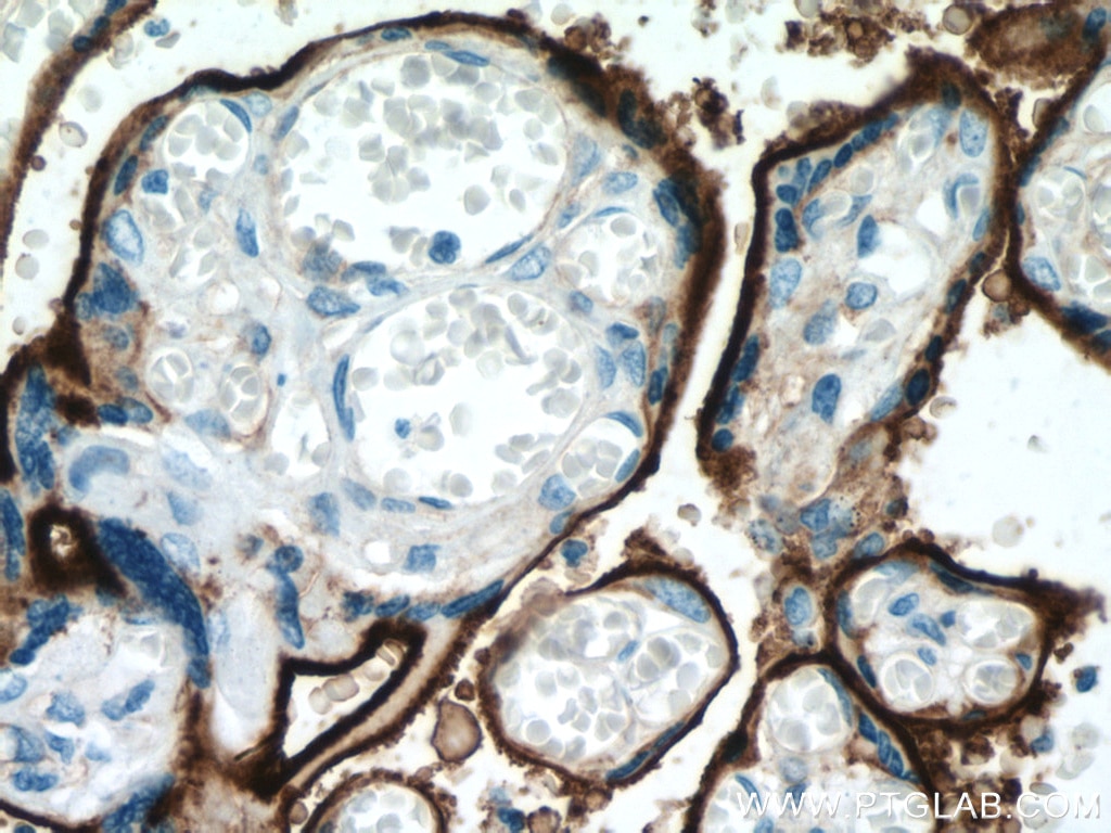 IHC staining of human placenta using 67075-1-Ig