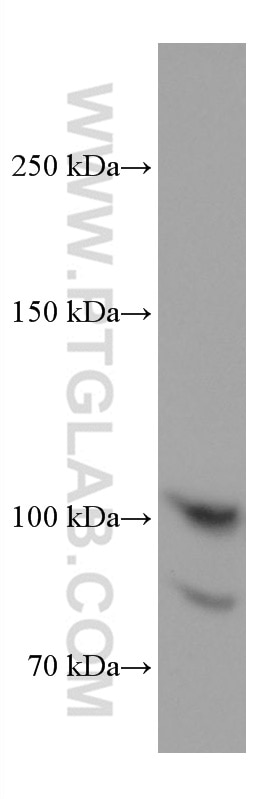 Western Blot (WB) analysis of HL-60 cells using Endoglin/CD105 Monoclonal antibody (67075-1-Ig)