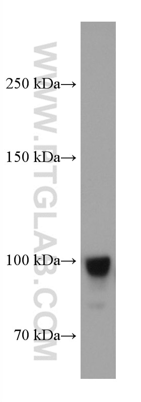 Western Blot (WB) analysis of HUVEC cells using Endoglin/CD105 Monoclonal antibody (67075-1-Ig)