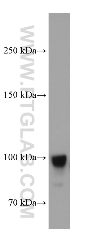 Western Blot (WB) analysis of HUVEC cells using Endoglin/CD105 Monoclonal antibody (67075-1-Ig)