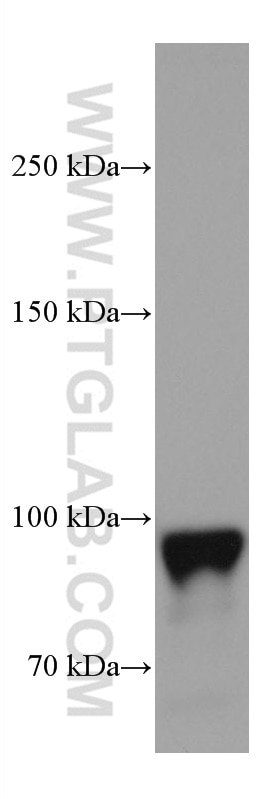 Western Blot (WB) analysis of human placenta tissue using Endoglin/CD105 Monoclonal antibody (67075-1-Ig)