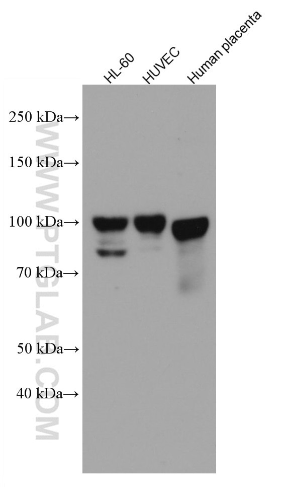 Western Blot (WB) analysis of various lysates using Endoglin/CD105 Monoclonal antibody (67075-1-Ig)