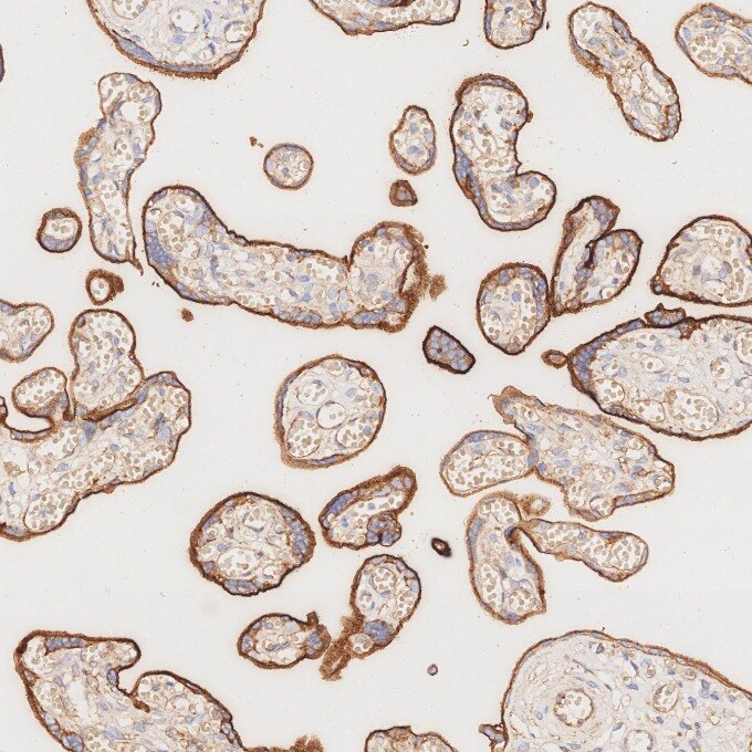 IHC staining of human placenta using 82993-6-RR Immunohistochemistry (IHC) staining of human placenta tissue using Endoglin/CD105 Recombinant monoclonal antibody (82993-6-RR)