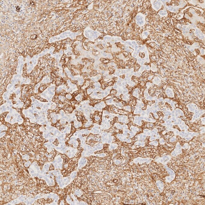 IHC staining of human liver using 82993-6-RR Immunohistochemistry (IHC) staining of human liver tissue using Endoglin/CD105 Recombinant monoclonal antibody (82993-6-RR)