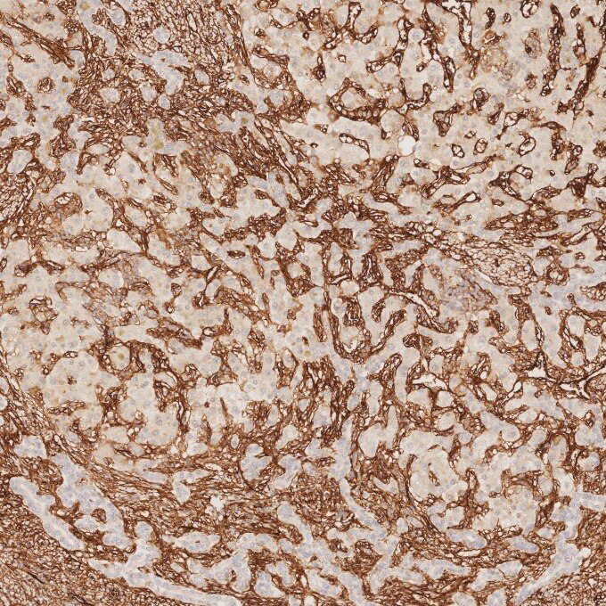 IHC staining of human liver using 82993-6-RR Immunohistochemistry (IHC) staining of human liver tissue using Endoglin/CD105 Recombinant monoclonal antibody (82993-6-RR)