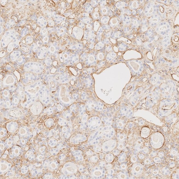 IHC staining of human kidney using 82993-6-RR Immunohistochemistry (IHC) staining of human kidney tissue using Endoglin/CD105 Recombinant monoclonal antibody (82993-6-RR)