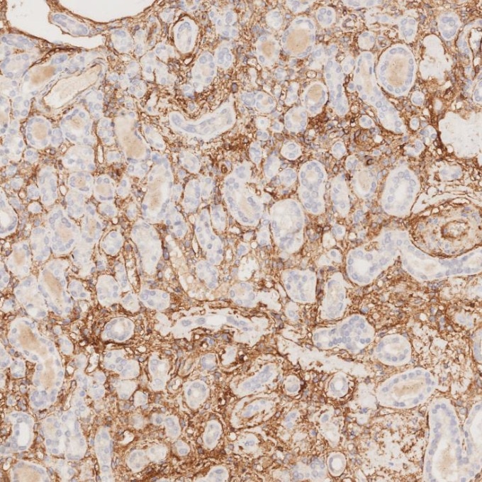 IHC staining of human kidney using 82993-6-RR Immunohistochemistry (IHC) staining of human kidney tissue using Endoglin/CD105 Recombinant monoclonal antibody (82993-6-RR)