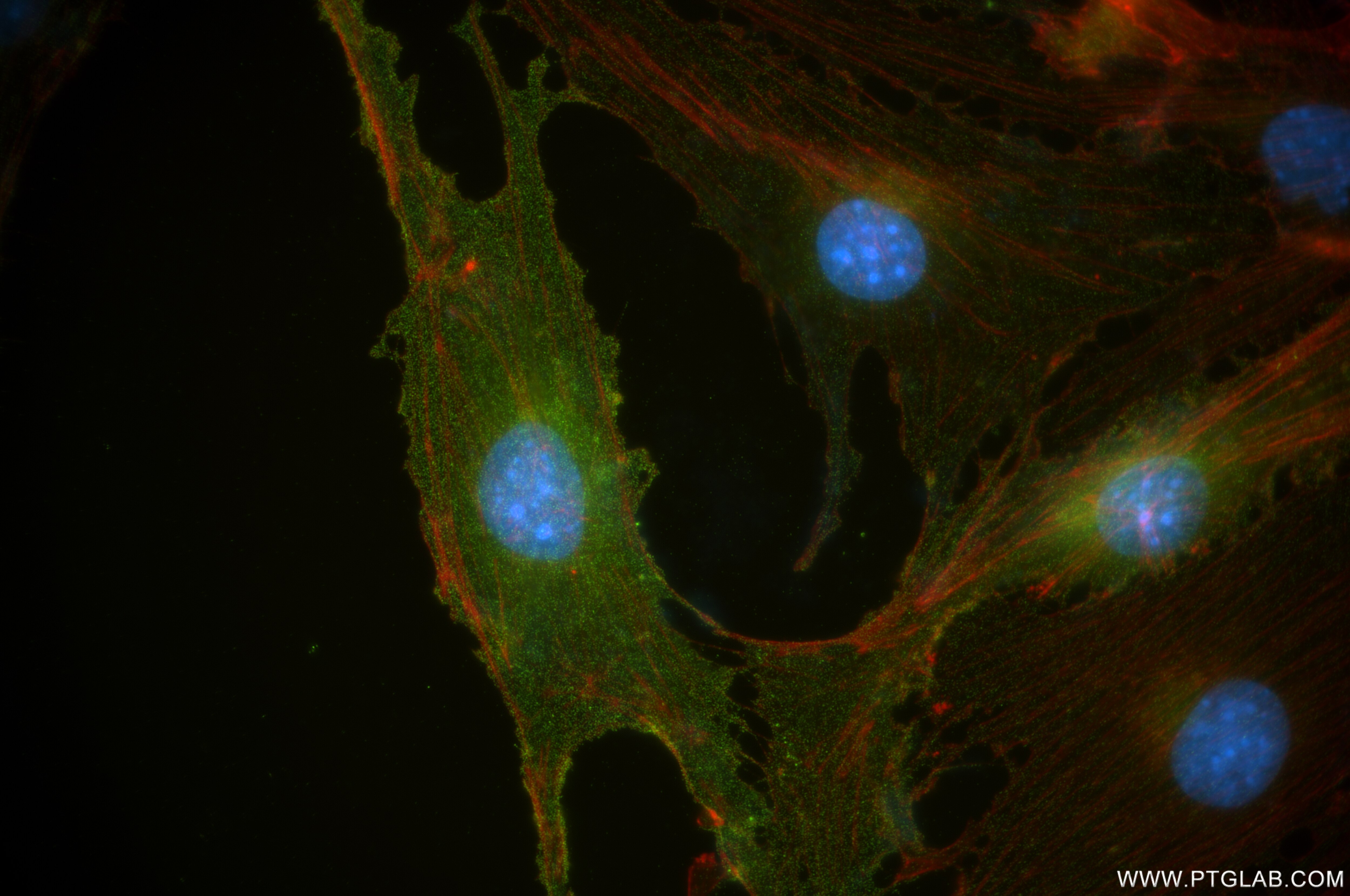 Immunofluorescence (IF) / fluorescent staining of bEnd.3 cells using Endoglin/CD105 Recombinant antibody (84807-4-RR)