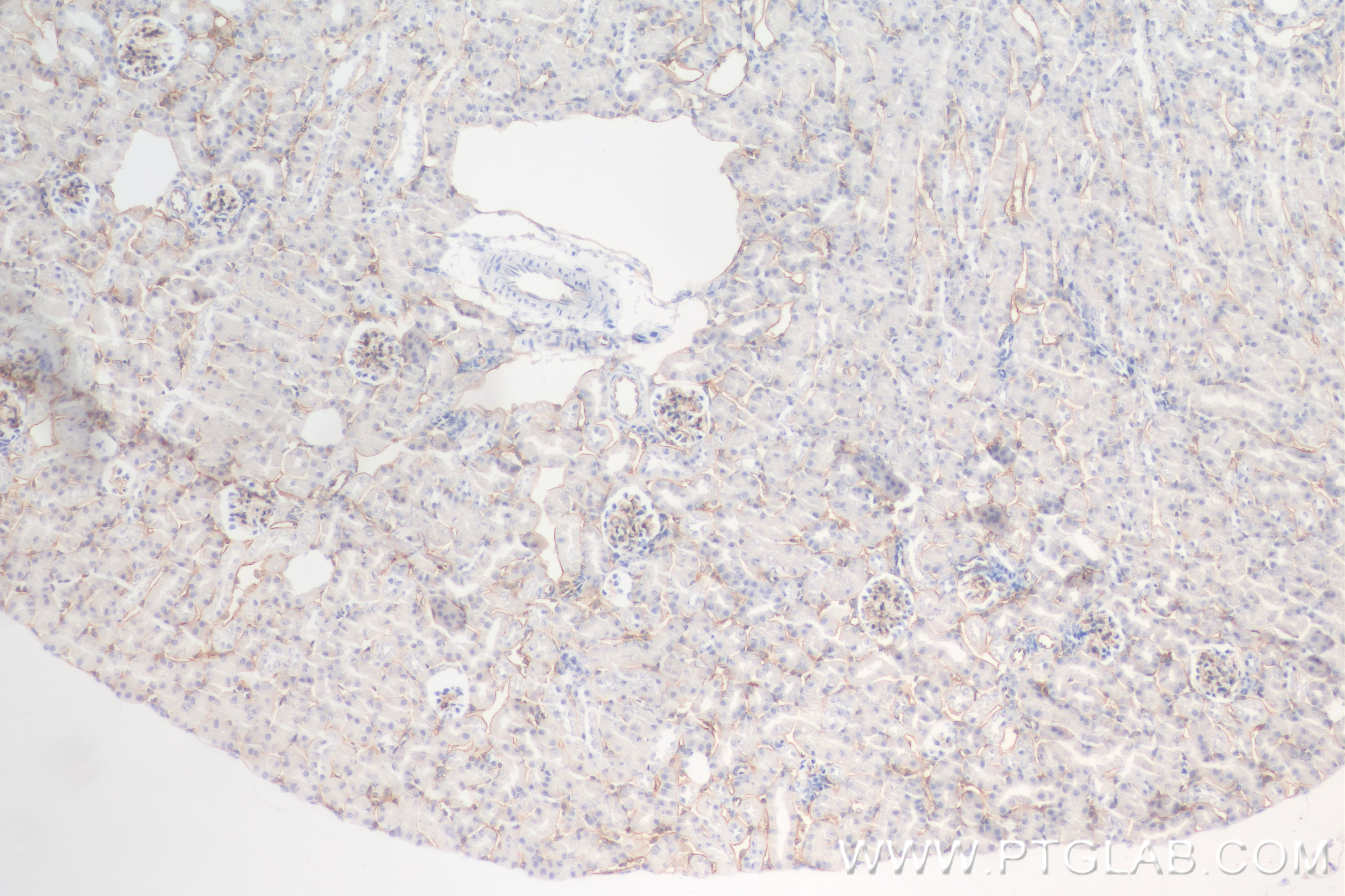 Immunohistochemistry (IHC) staining of mouse kidney tissue using Endoglin/CD105 Recombinant antibody (84807-4-RR)