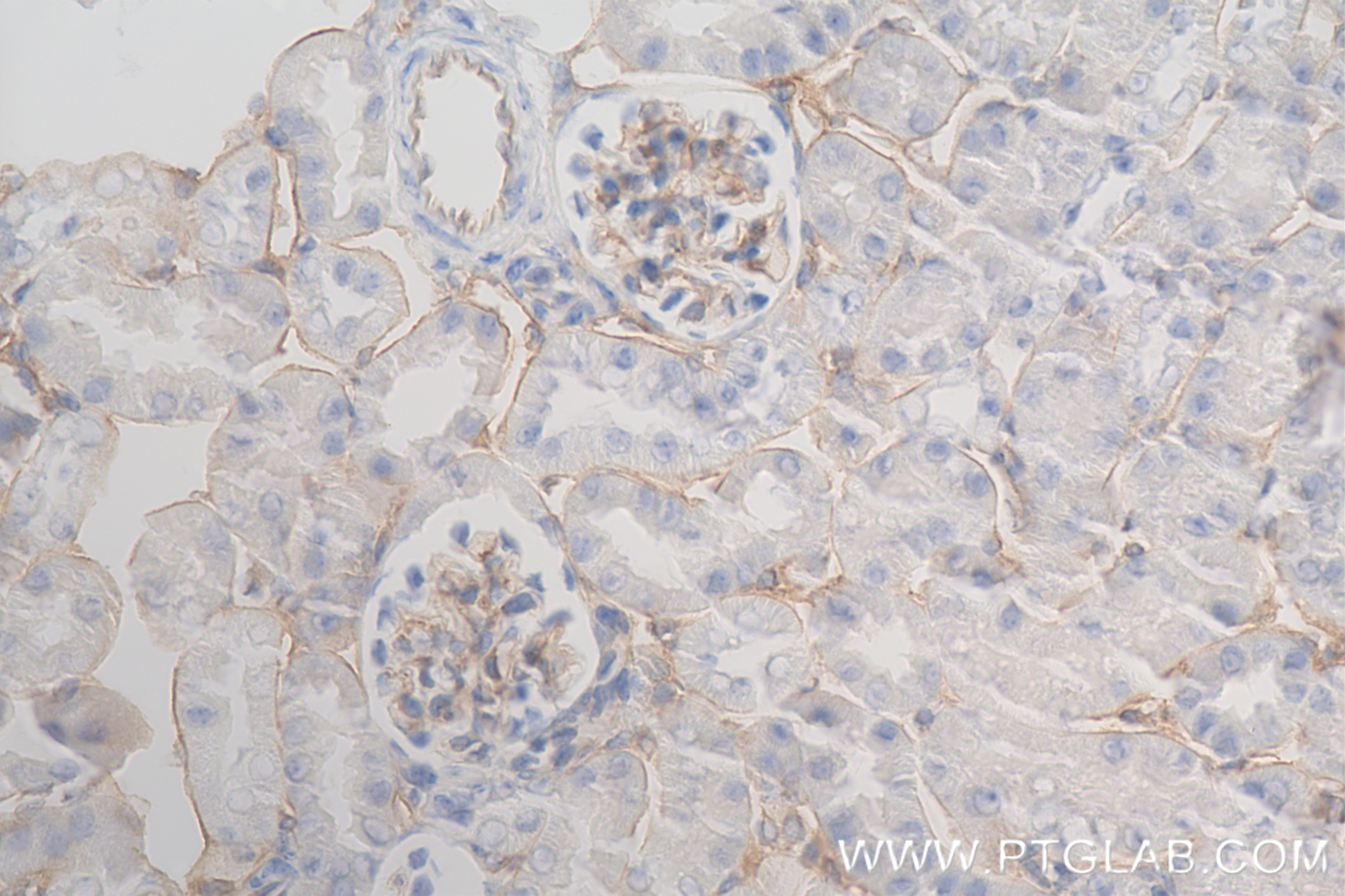 Immunohistochemistry (IHC) staining of mouse kidney tissue using Endoglin/CD105 Recombinant antibody (84807-4-RR)