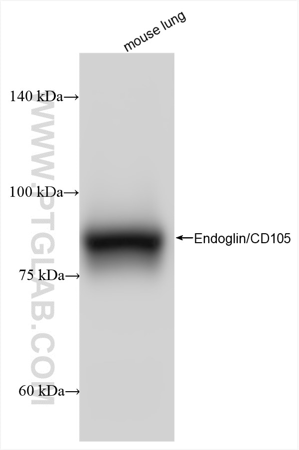 Western Blot (WB) analysis of various lysates using Endoglin/CD105 Recombinant antibody (84807-4-RR)