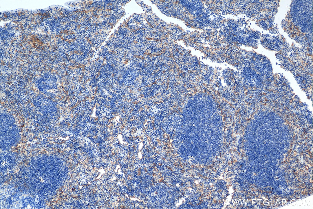Immunohistochemical analysis of paraffin-embedded mouse spleen tissue slide using 84807-5-RR (Endoglin/CD105 antibody) at dilution of 1:1000 (under 10x lens). Heat mediated antigen retrieval with Tris-EDTA buffer (pH 9.0). Immunohistochemistry (IHC) staining of mouse spleen tissue using Endoglin/CD105 Recombinant monoclonal antibody (84807-5-RR)