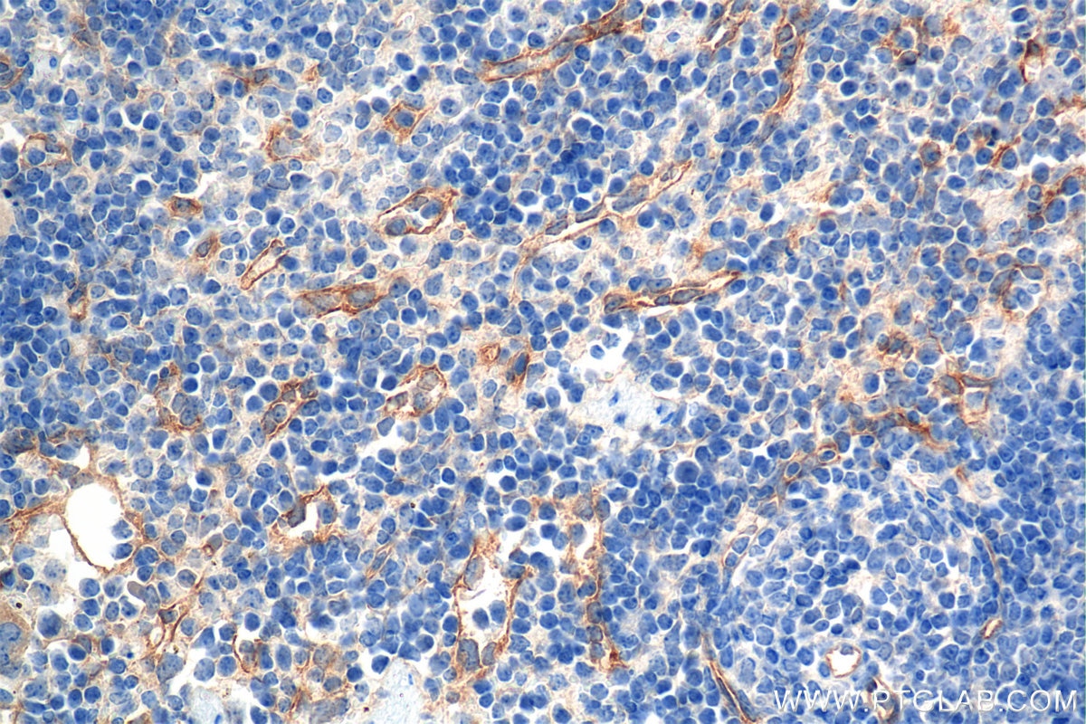 Immunohistochemical analysis of paraffin-embedded mouse spleen tissue slide using 84807-5-RR (Endoglin/CD105 antibody) at dilution of 1:1000 (under 40x lens). Heat mediated antigen retrieval with Tris-EDTA buffer (pH 9.0). Immunohistochemistry (IHC) staining of mouse spleen tissue using Endoglin/CD105 Recombinant monoclonal antibody (84807-5-RR)