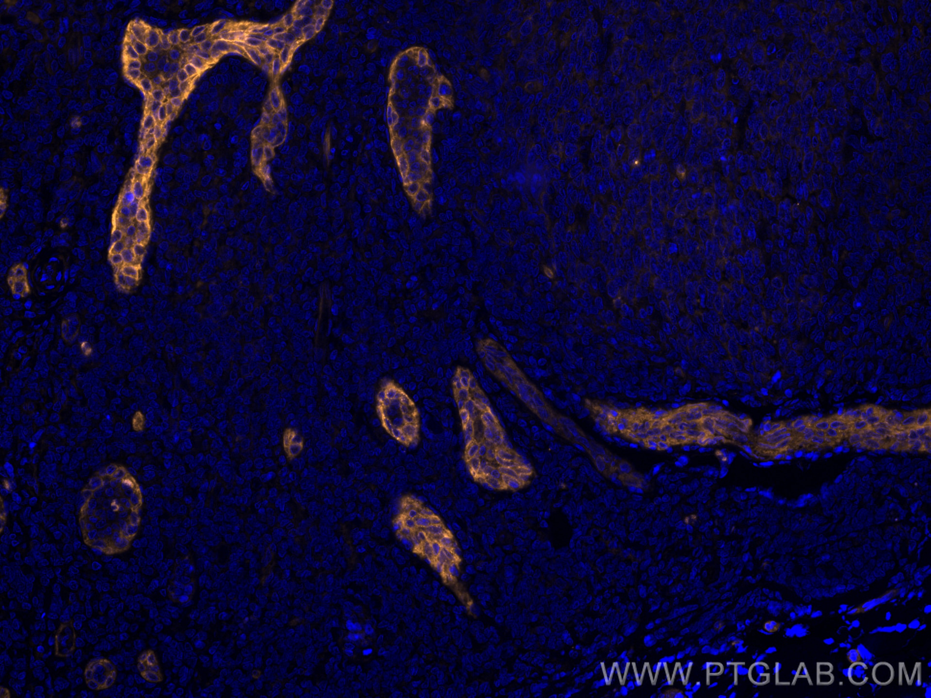 Immunofluorescence (IF) / fluorescent staining of human tonsillitis tissue using CoraLite®555-conjugated Endoglin/CD105 Monoclonal  (CL555-67075)