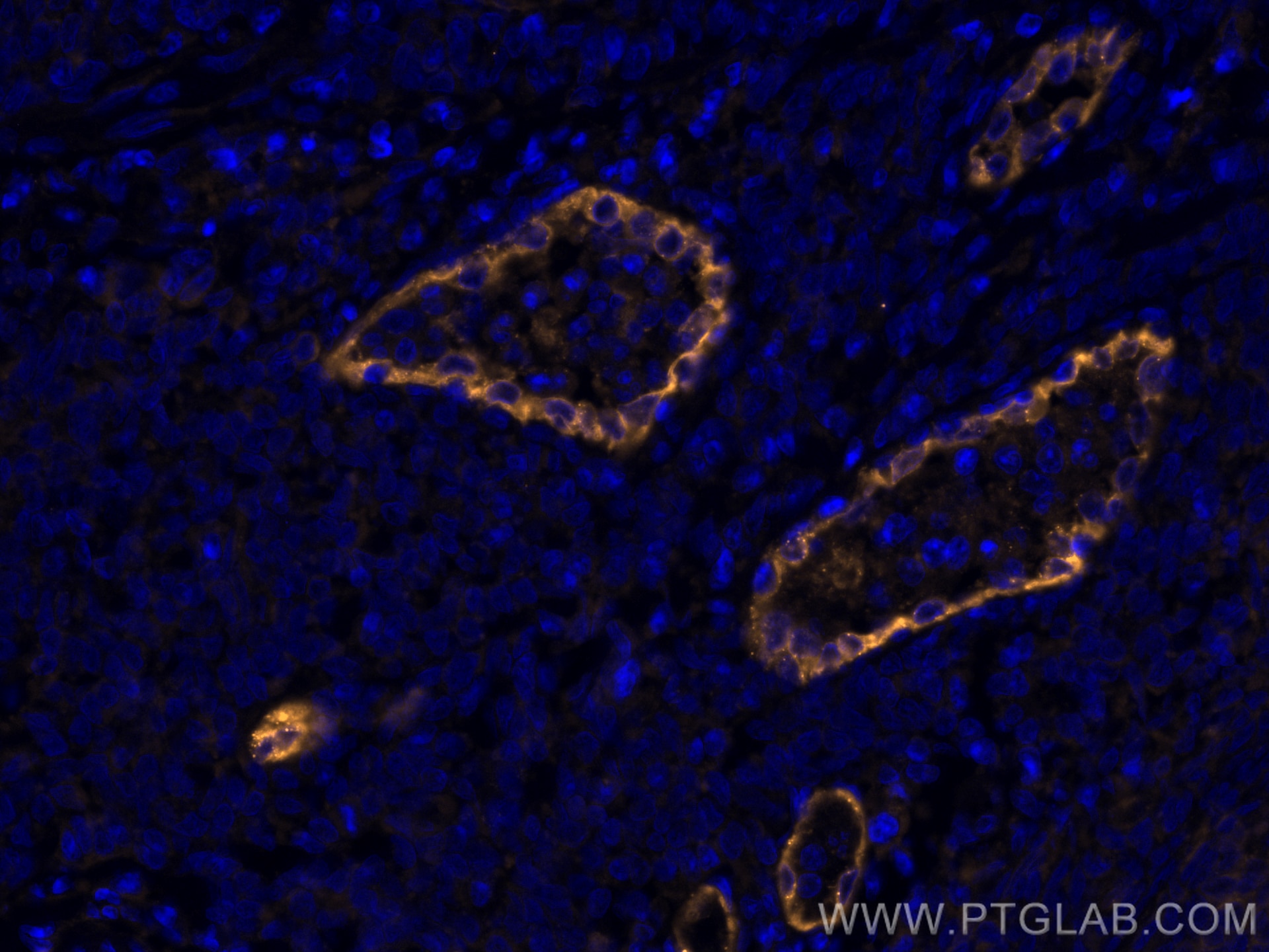 Immunofluorescence (IF) / fluorescent staining of human tonsillitis tissue using CoraLite®555-conjugated Endoglin/CD105 Monoclonal  (CL555-67075)