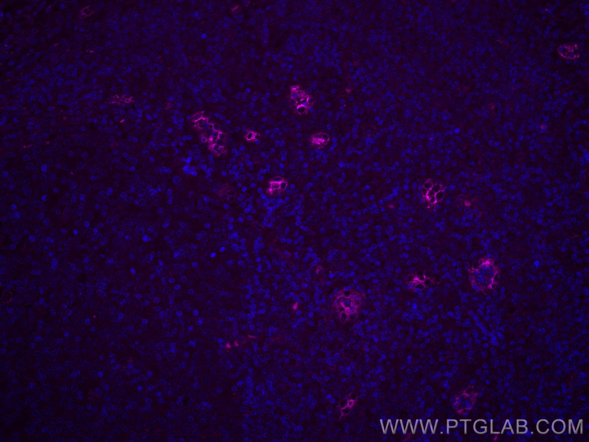 IF Staining of human tonsillitis using CL647-67075