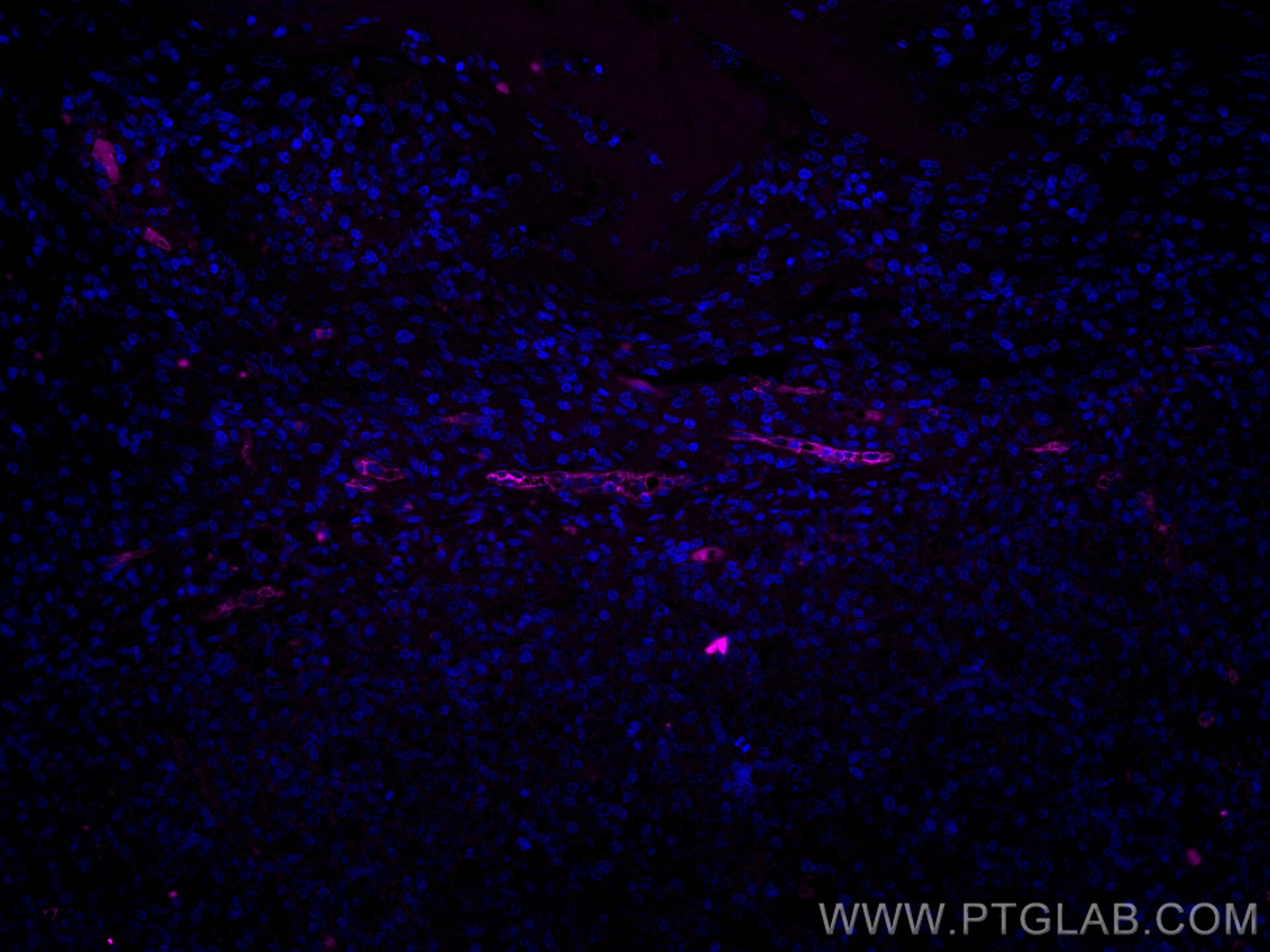 IF Staining of human tonsillitis using CL647-67075