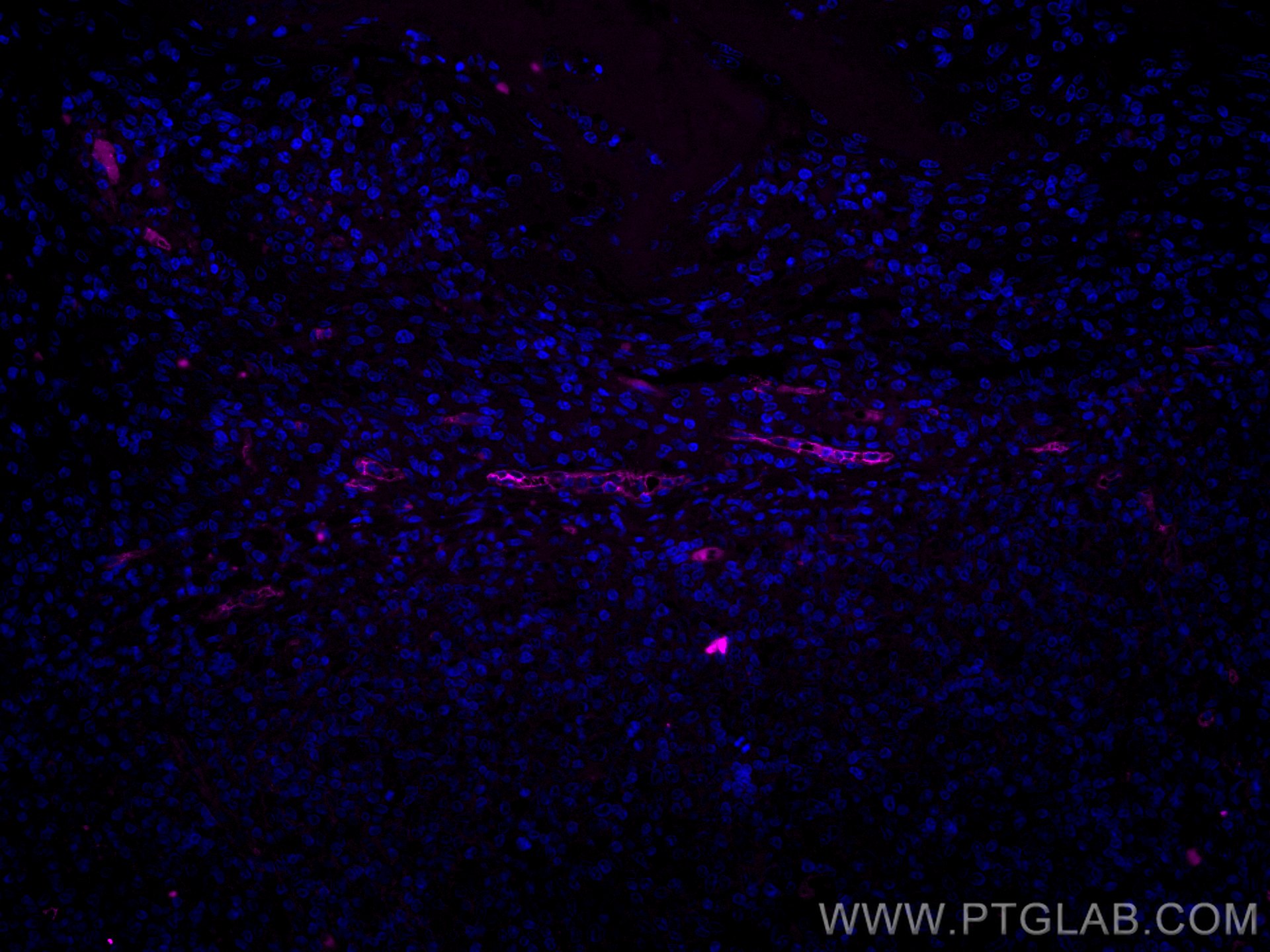 Immunofluorescence (IF) / fluorescent staining of human tonsillitis tissue using CoraLite® Plus 647-conjugated Endoglin/CD105 Monoc (CL647-67075)