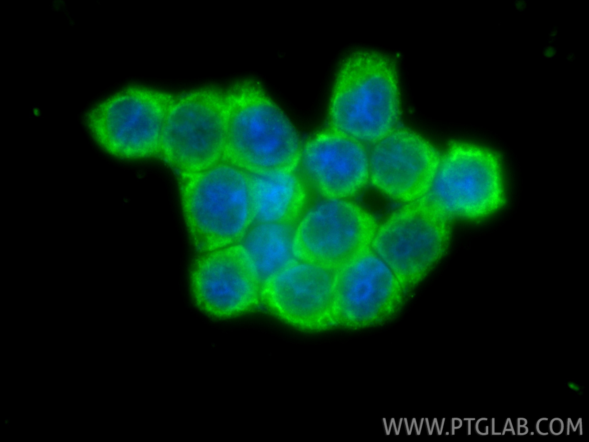 Immunofluorescence (IF) / fluorescent staining of BxPC-3 cells using Endothelin 3 Polyclonal antibody (27871-1-AP)