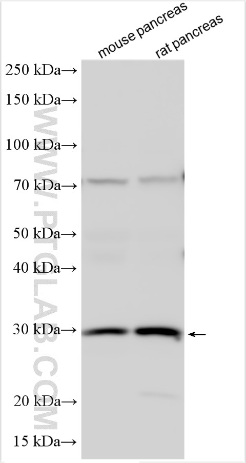 Endothelin 3