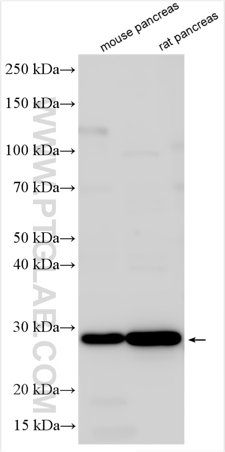 Western Blot (WB) analysis of various lysates using Endothelin 3 Polyclonal antibody (27871-1-AP)