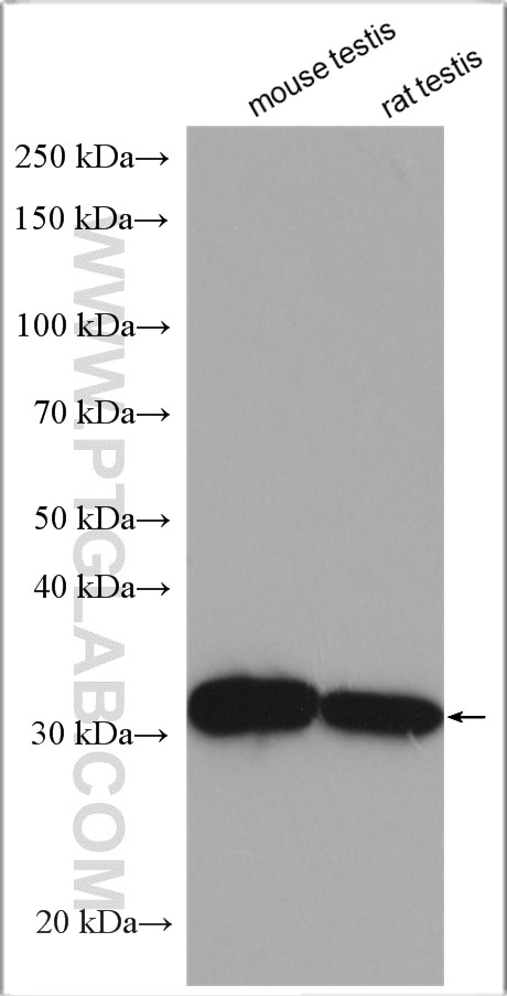 Western Blot (WB) analysis of various lysates using Enkurin Polyclonal antibody (26440-1-AP)