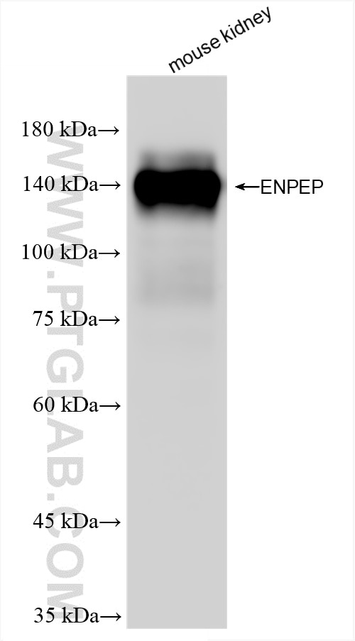 Western Blot (WB) analysis of various lysates using Enpep Recombinant antibody (86110-1-RR)