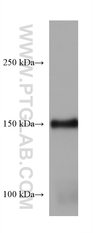 Western Blot (WB) analysis of rat kidney tissue using Entactin Monoclonal antibody (67310-1-Ig)