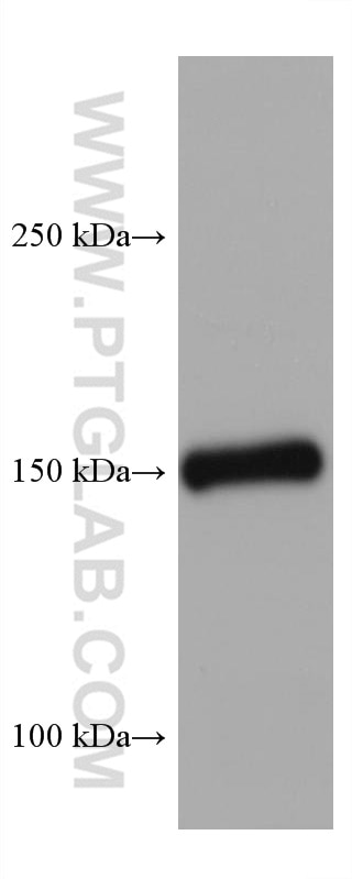 WB analysis of mouse kidney using 67310-1-Ig