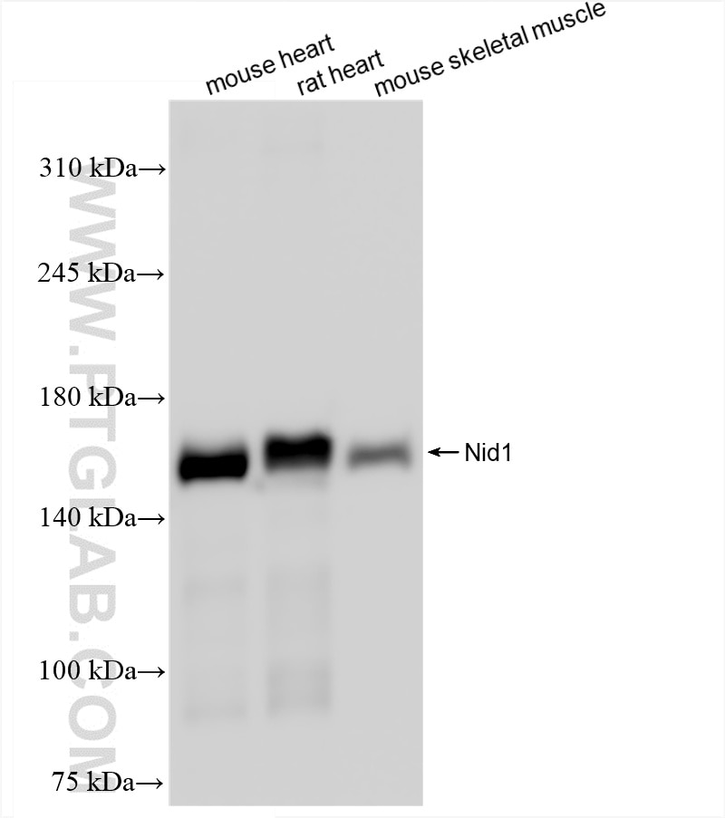 Western Blot (WB) analysis of various lysates using Entactin Recombinant antibody (86456-1-RR)