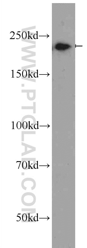 Western Blot (WB) analysis of A431 cells using Envoplakin Polyclonal antibody (25441-1-AP)