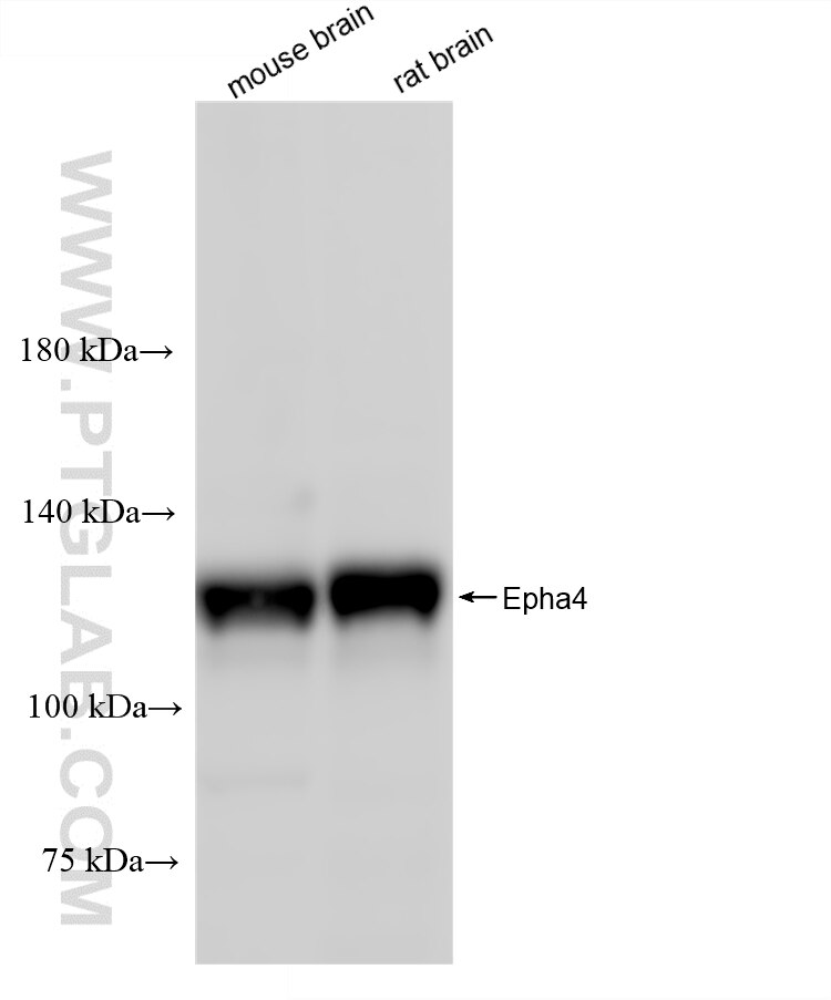 WB analysis using 88021-1-RR (same clone as 88021-1-PBS) Western Blot (WB) analysis of various lysates using Epha4 Recombinant monoclonal antibody (88021-1-RR)