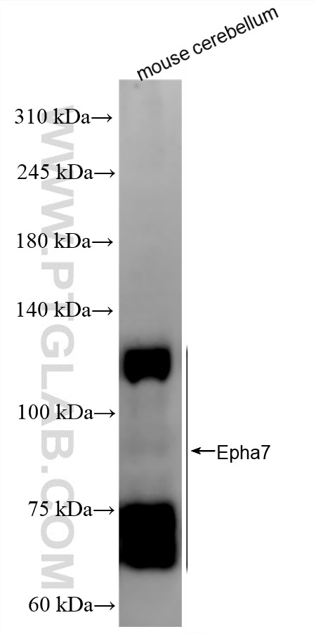 Western Blot (WB) analysis of various lysates using Epha7 Recombinant monoclonal antibody (87966-1-RR)