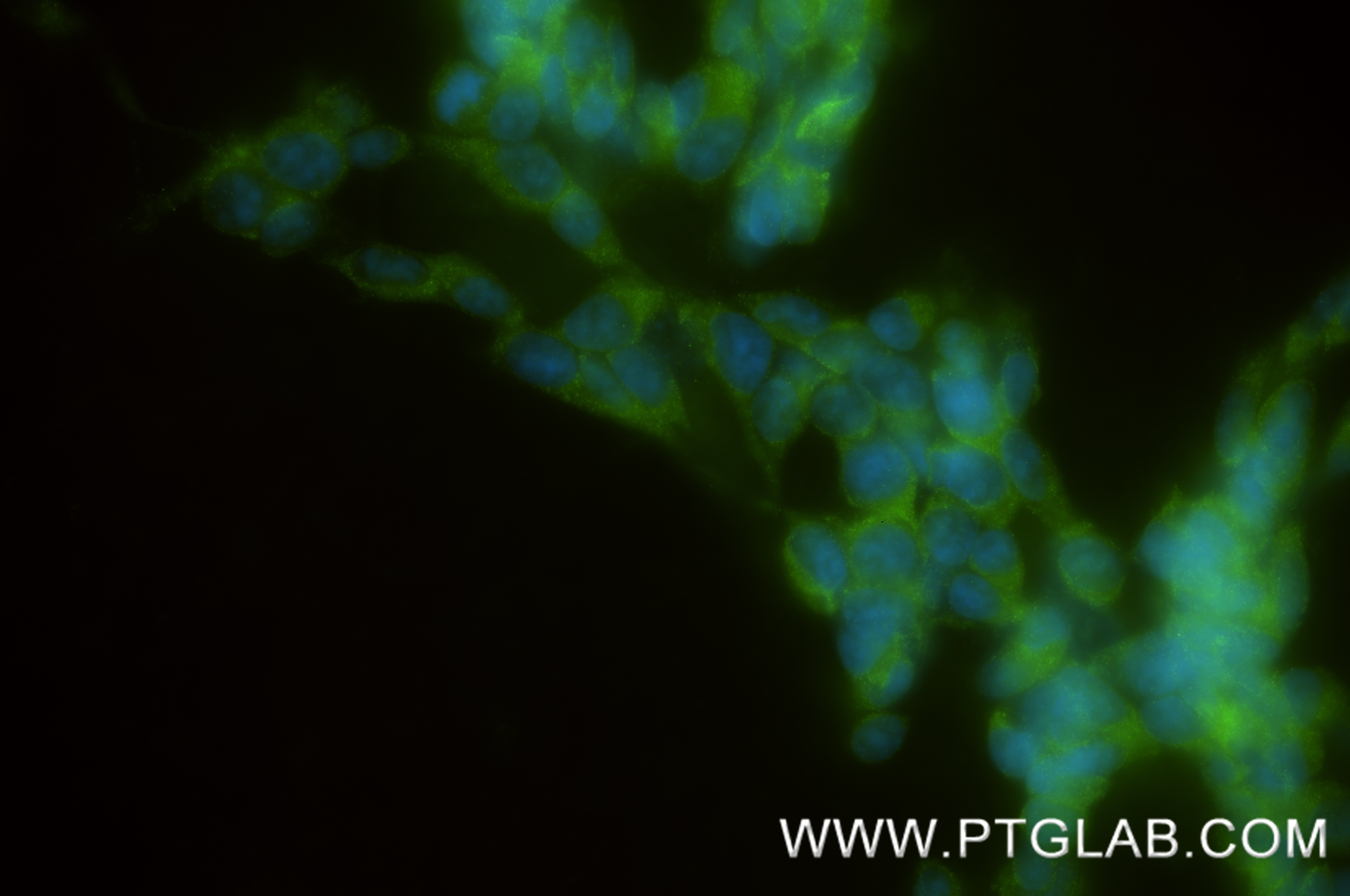 IF Staining of SH-SY5Y using 87995-1-RR (same clone as 87995-1-PBS) Immunofluorescence (IF) / fluorescent staining of SH-SY5Y cells using Ephrin B2 Recombinant monoclonal antibody (87995-1-RR)