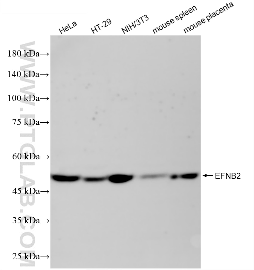WB analysis using 87995-1-RR (same clone as 87995-1-PBS) Western Blot (WB) analysis of various lysates using Ephrin B2 Recombinant monoclonal antibody (87995-1-RR)