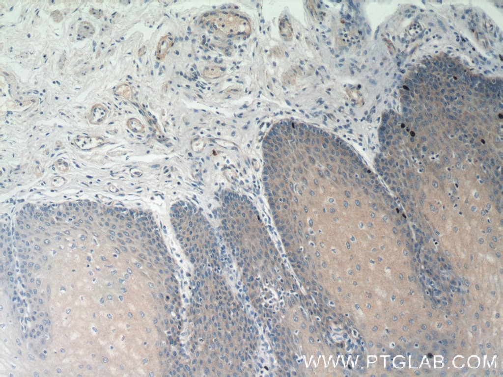 Immunohistochemistry (IHC) staining of human oesophagus tissue using Epigen Polyclonal antibody (25113-1-AP)