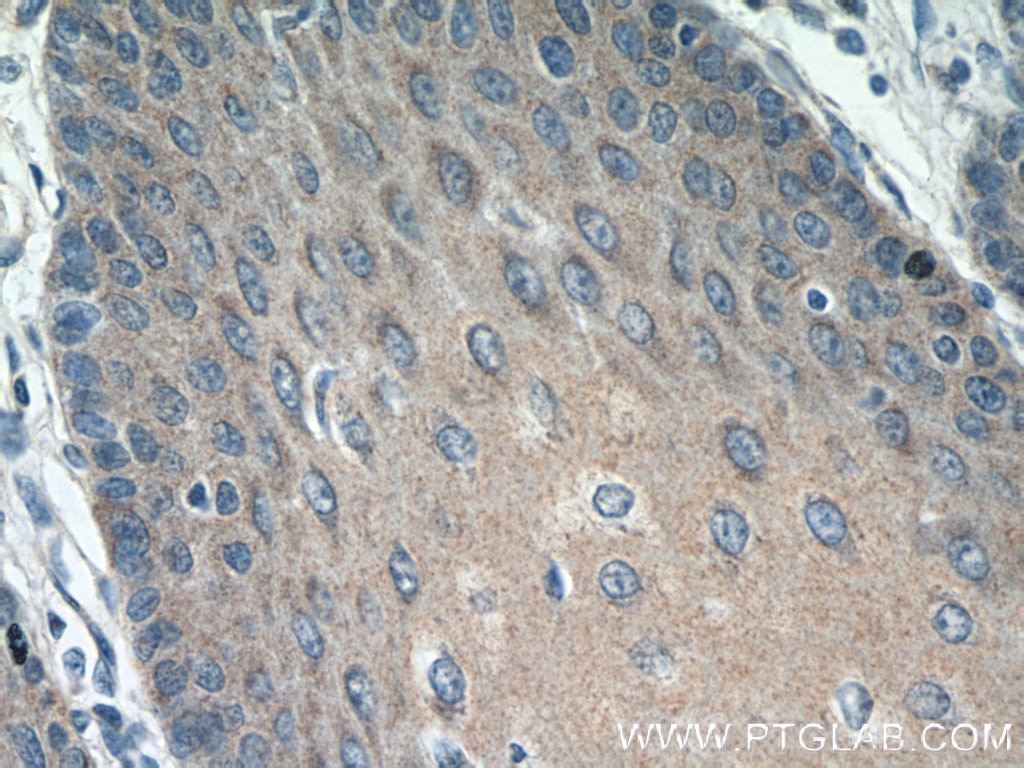 Immunohistochemistry (IHC) staining of human oesophagus tissue using Epigen Polyclonal antibody (25113-1-AP)