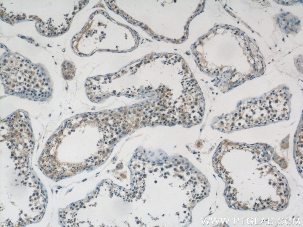 Immunohistochemistry (IHC) staining of human testis tissue using Epigen Polyclonal antibody (25113-1-AP)