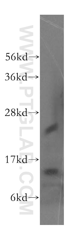 Western Blot (WB) analysis of mouse liver tissue using Evi2a Polyclonal antibody (51014-2-AP)