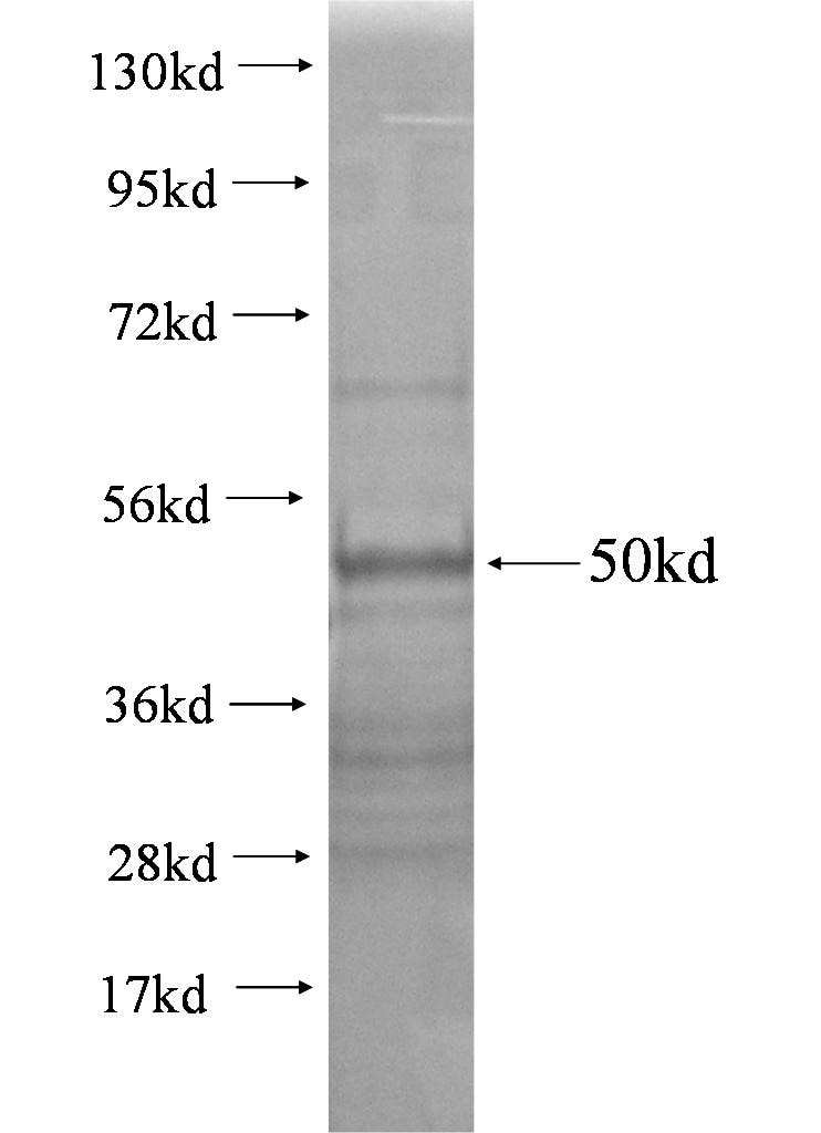 Evi2a fusion protein Ag0478 SDS-PAGE