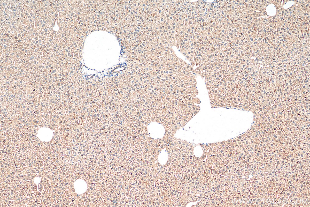 Immunohistochemistry (IHC) staining of mouse liver tissue using Exportin 4 Polyclonal antibody (25373-1-AP)