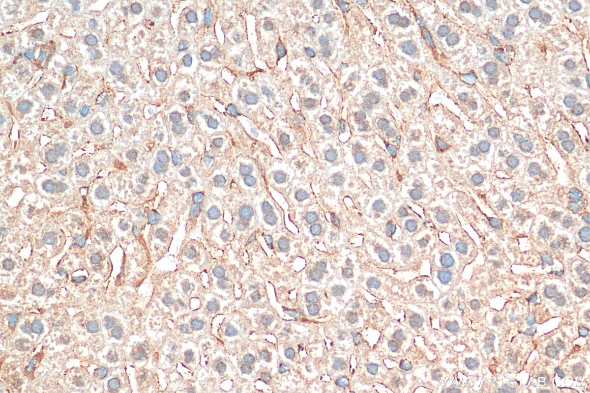 Immunohistochemistry (IHC) staining of mouse liver tissue using Exportin 4 Polyclonal antibody (25373-1-AP)