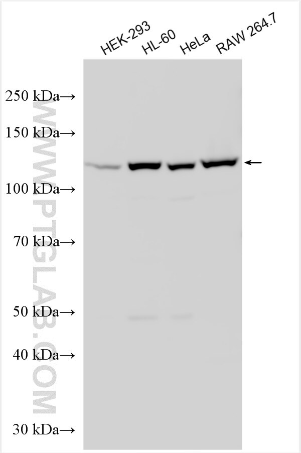 Western Blot (WB) analysis of various lysates using Exportin 4 Polyclonal antibody (25373-1-AP)