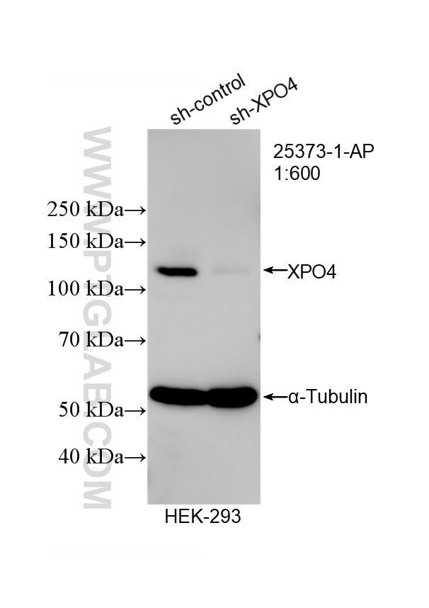 Western Blot (WB) analysis of HEK-293 cells using Exportin 4 Polyclonal antibody (25373-1-AP)