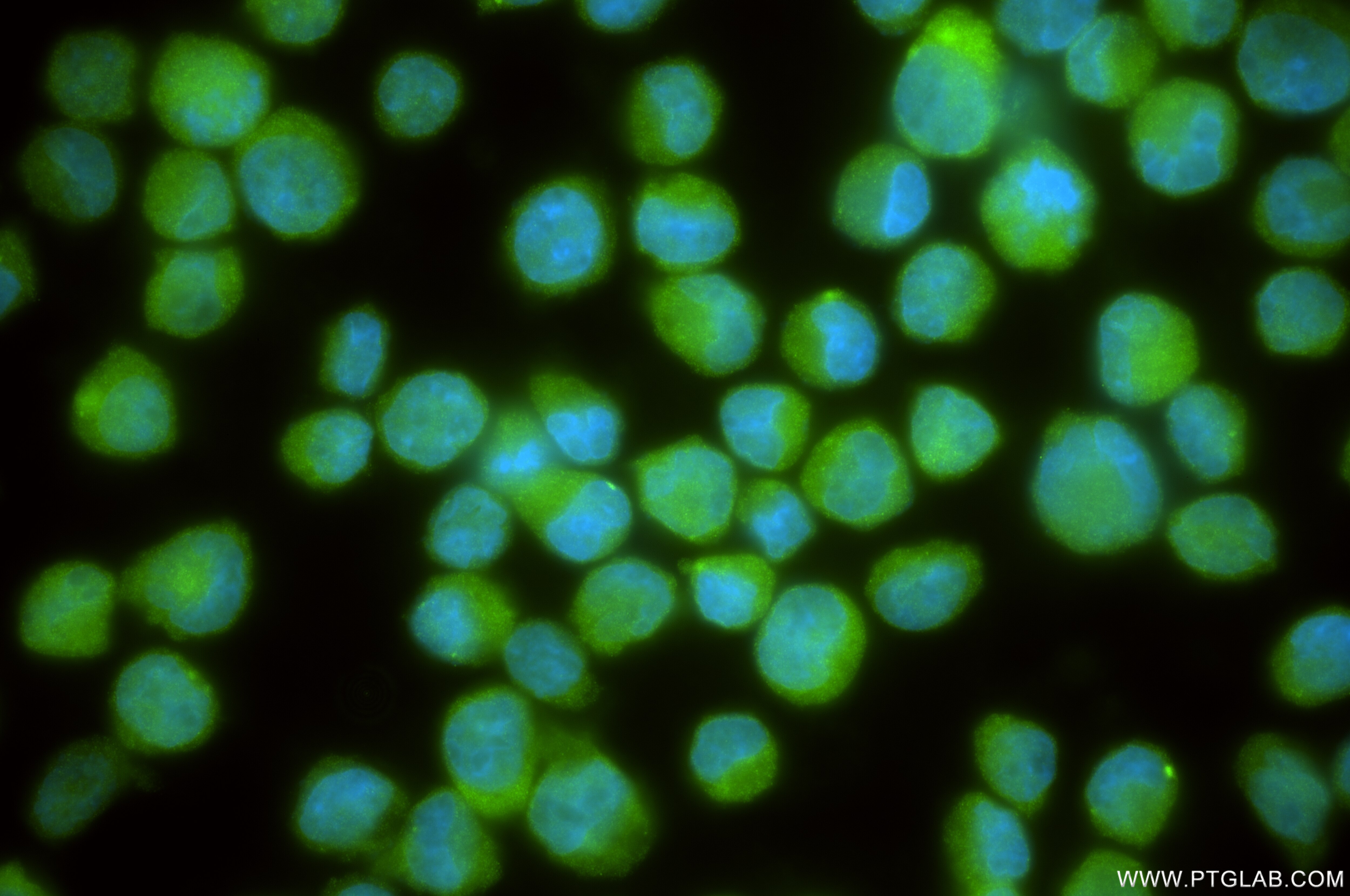 Immunofluorescence (IF) / fluorescent staining of K-562 cells using Exportin 4 Recombinant antibody (84449-1-RR)