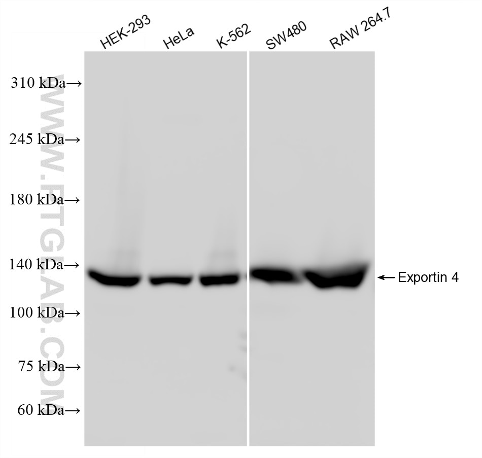 Western Blot (WB) analysis of various lysates using Exportin 4 Recombinant antibody (84449-1-RR)