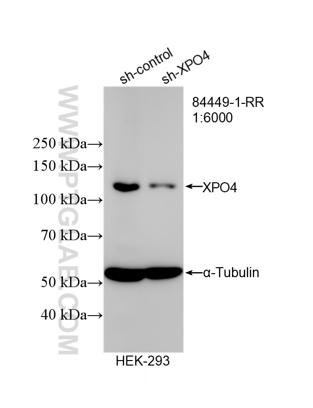 WB result of Exportin 4 antibody (84449-1-RR; 1:6000; incubated at room temperature for 1.5 hours) with sh-Control and sh-Exportin 4 transfected HEK-293 cells. This data was developed using the same antibody clone with 84449-1-PBS in a different storage buffer formulation. Western Blot (WB) analysis of HEK-293 cells using Exportin 4 Recombinant antibody (84449-1-RR)