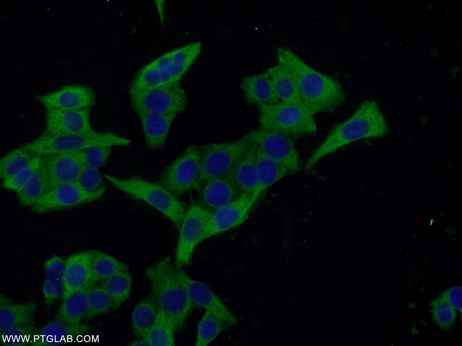 Immunofluorescence (IF) / fluorescent staining of HeLa cells using Ezrin Polyclonal antibody (26056-1-AP)